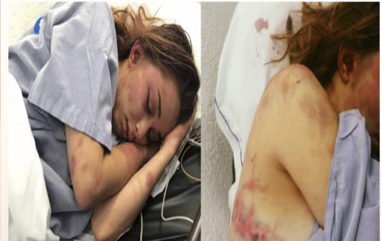 Gobierno del Estado atiende caso de joven mujer víctima de violencia @Mauvila