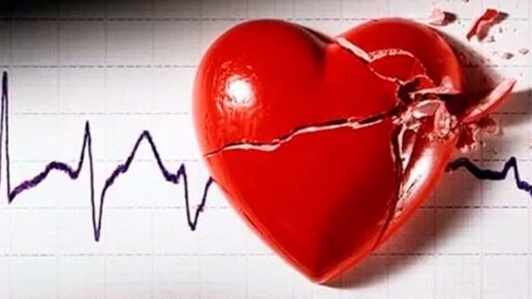 Muerte súbita cardiaca