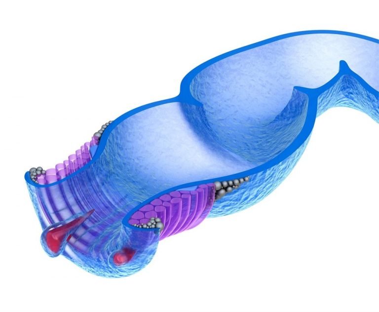 Que es una Fistula Anal Proctologia