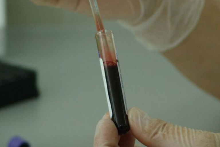 Vacuna experimental contra el VIH resulta prometedora en animales